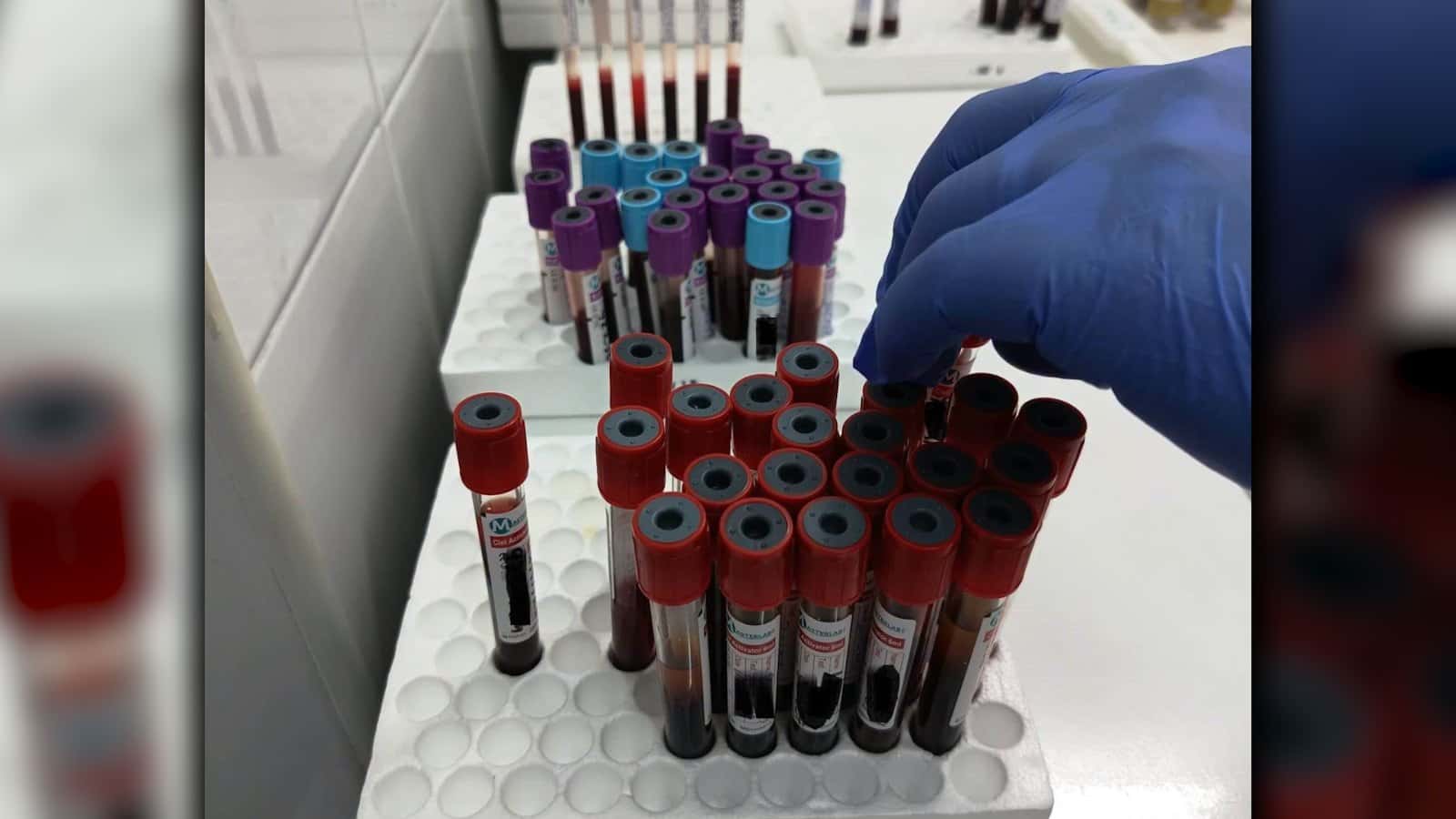 Analize medicale la SJU Târgu Jiu mai ieftine decât la privat