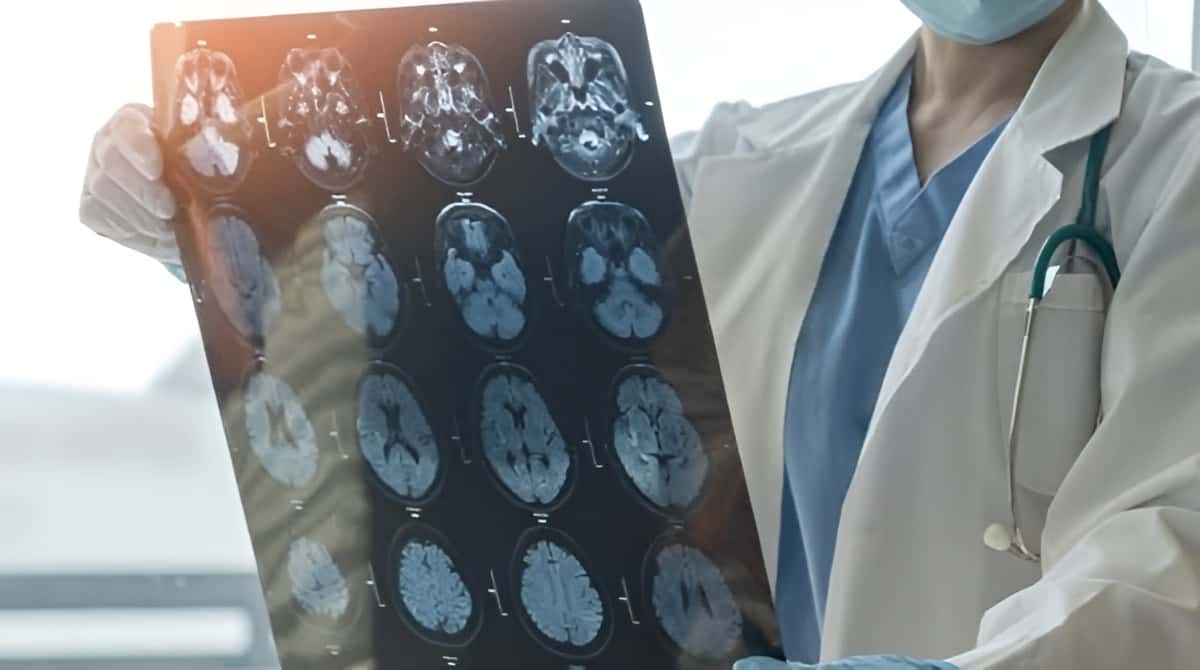Consultații neurologice gratuite la SJU Târgu Jiu